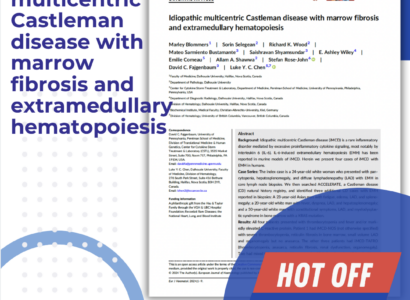 Idiopathic multicentric Castleman disease with marrow fibrosis and extramedullary hematopoiesis